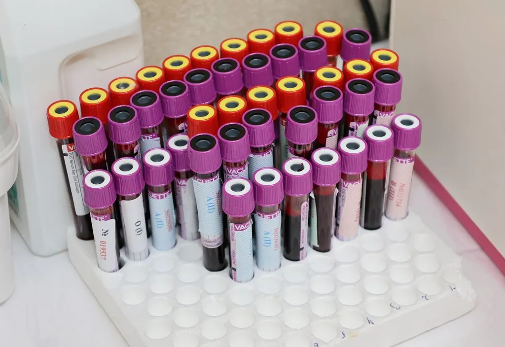 Fileiras de tubos de amostra em laboratório
