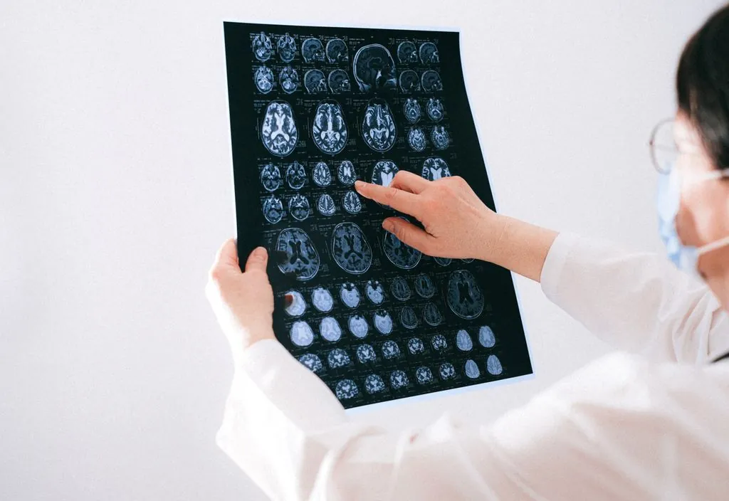 Neurologista apontando para ressonância do cérebro