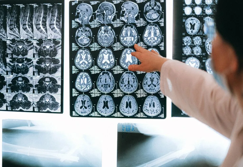 Médico analisando exames de imagem do cérebro