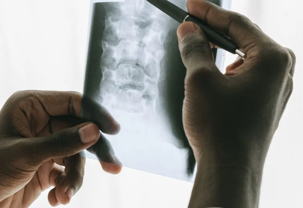 Radiologista analisando raio-x de tórax